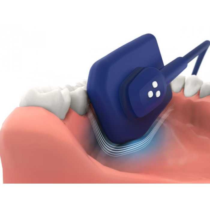 EzSensor Soft - цифровой радиовизиограф  - визиограф Vatech (Ю. Корея)