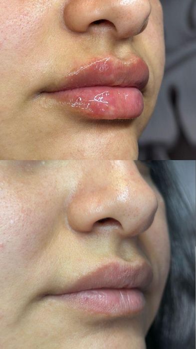 Ботокс губ,Чистка лица, Витамины для лица
Запись в по телефону
Запись