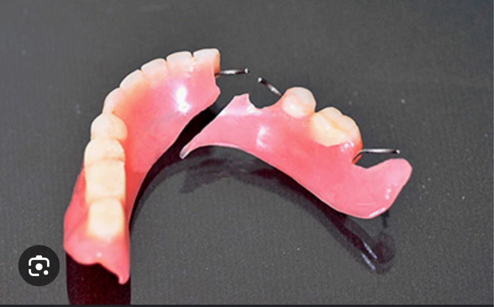 Протез ремонт пачинка