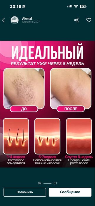 Лазерный эпилятор