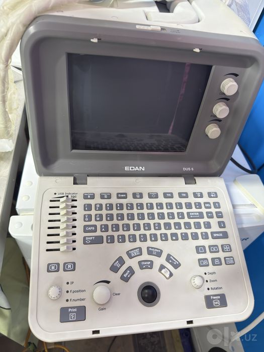 Uzi aparat sotiladi