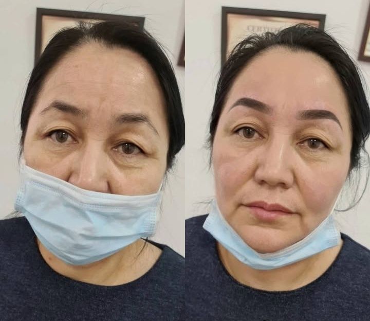 Информация для женщин.