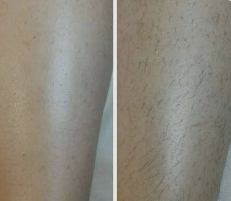 Шугаринг Усть-Каменогорск