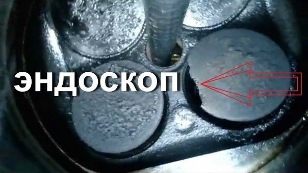 эндаскоп камера билан диагностика хизмати