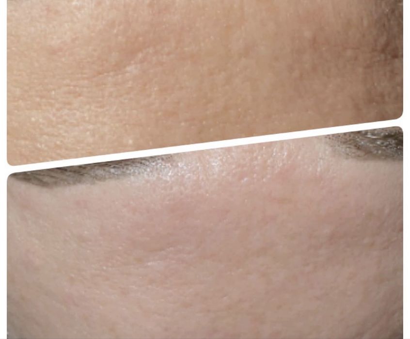 Шугаринг,косметология ,массаж