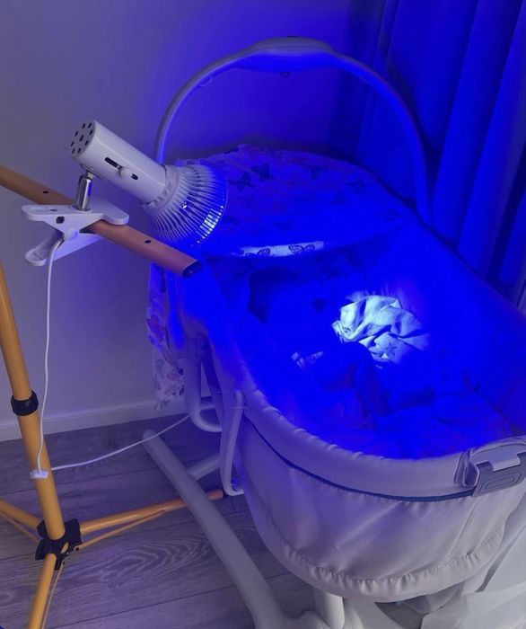 Фотолампа от желтушки