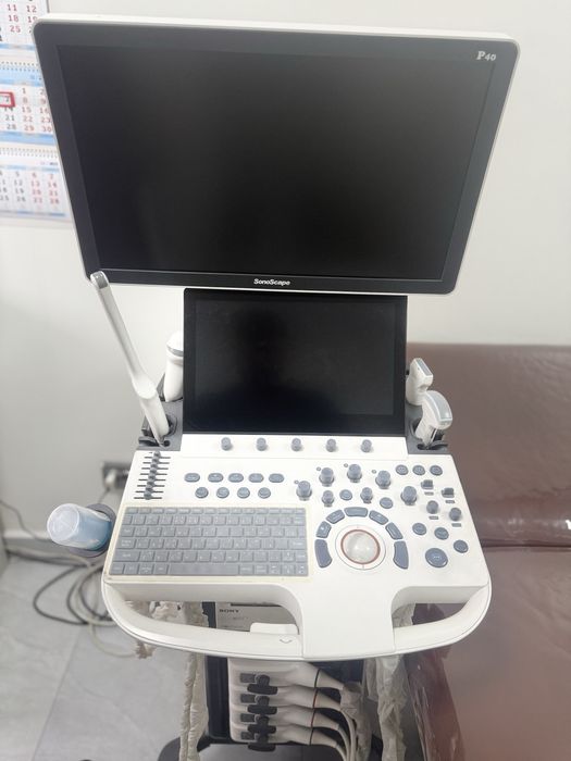 Узи аппарат SonoScape P40