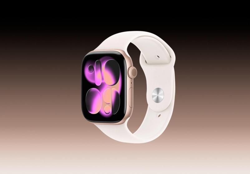 Apple Watch 11 46 m Gold