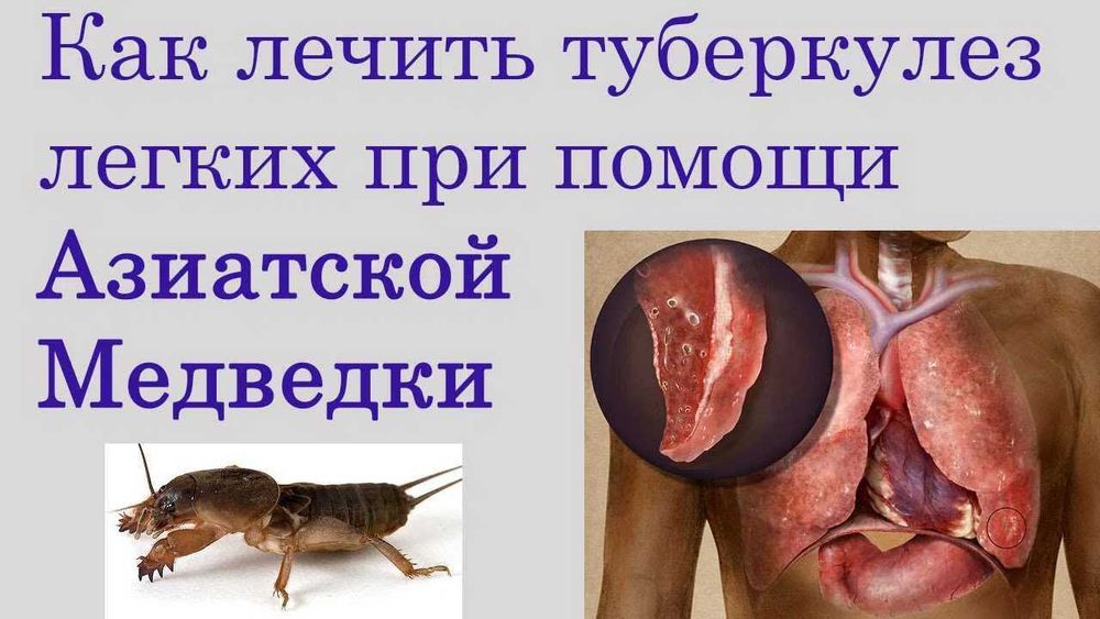 Медведка для лечения туберкулеза и пневмонии.