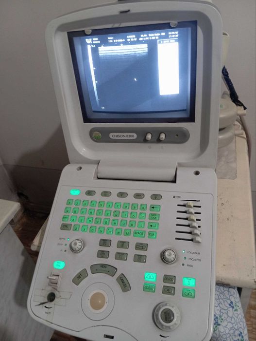 Chison 8300 УЗИ аппарат