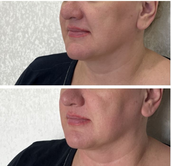 Массаж лица в Караганде