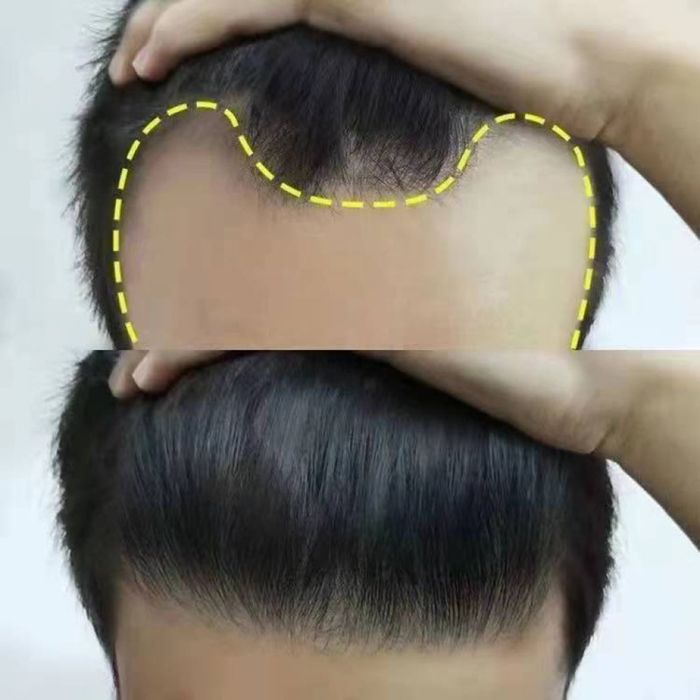 Серум за растеж на косата