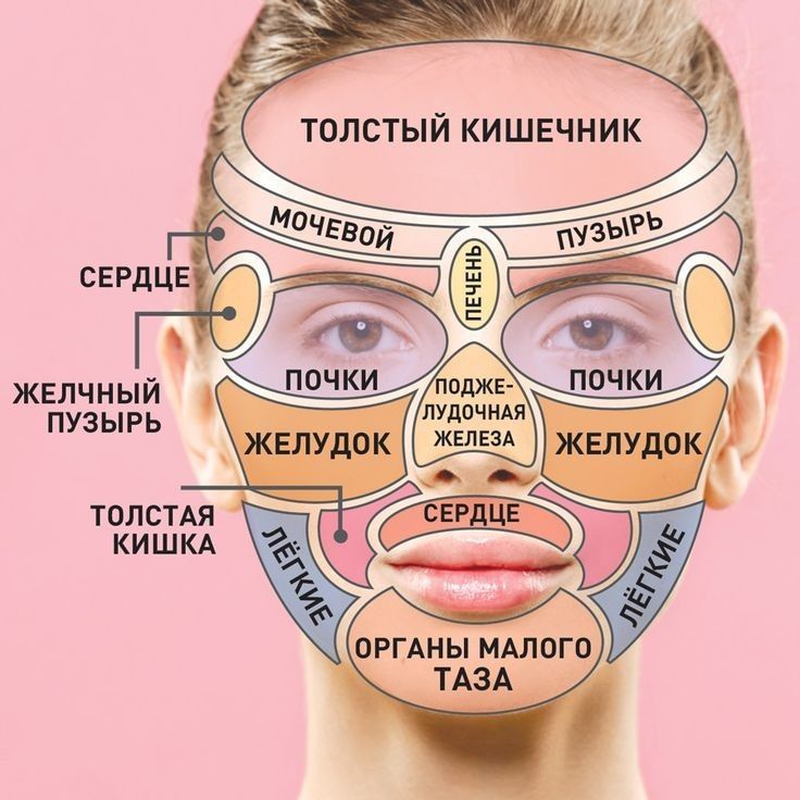 Прыщи на лице у женщин фото