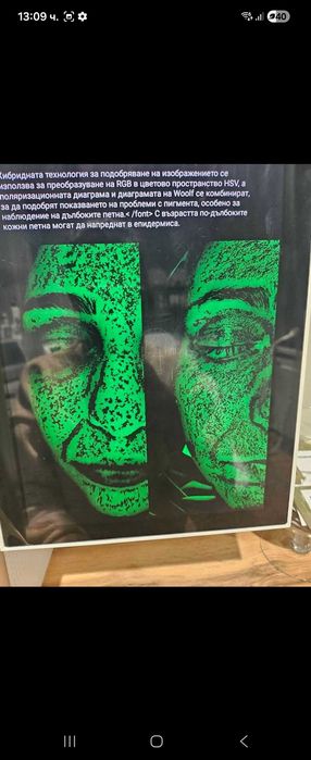 Анализатор на кожата / Skin check