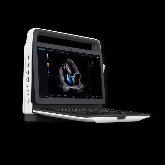 Ультразвуковая диагностическая система (УЗИ аппараты) UZI APPARAT