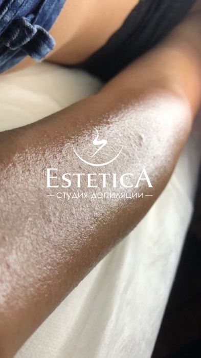 EsteticA - студия шугаринг, ваксинга, массажа