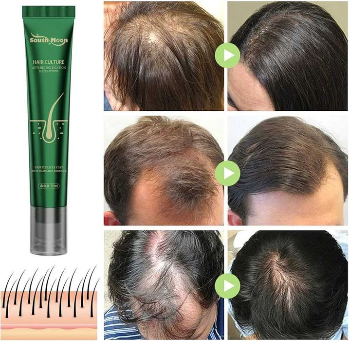 ПРОМО ЦЕНА! Серум против косопад, 20мл