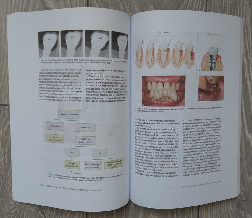 Zero Bone Loss Concepts - Tomas Linkevicius 2019
