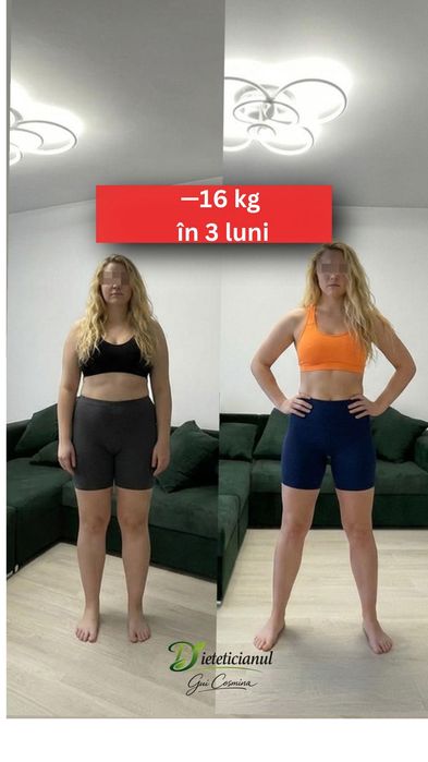 Nutritionist și Dietetician - prima consultație GRATUITĂ