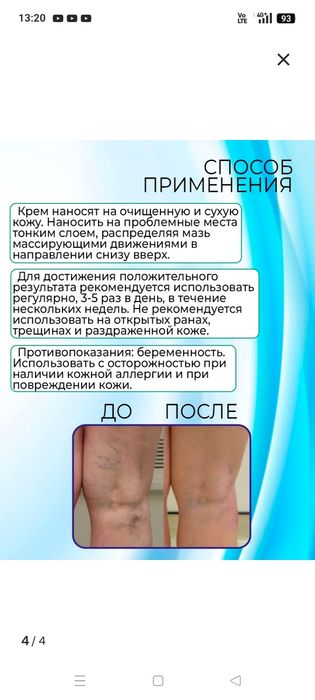 Продам крем от варикоза