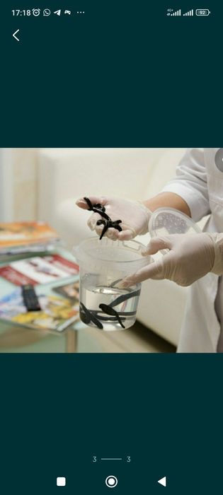 Пиявки.  Сүлік.    Гирудотерапия