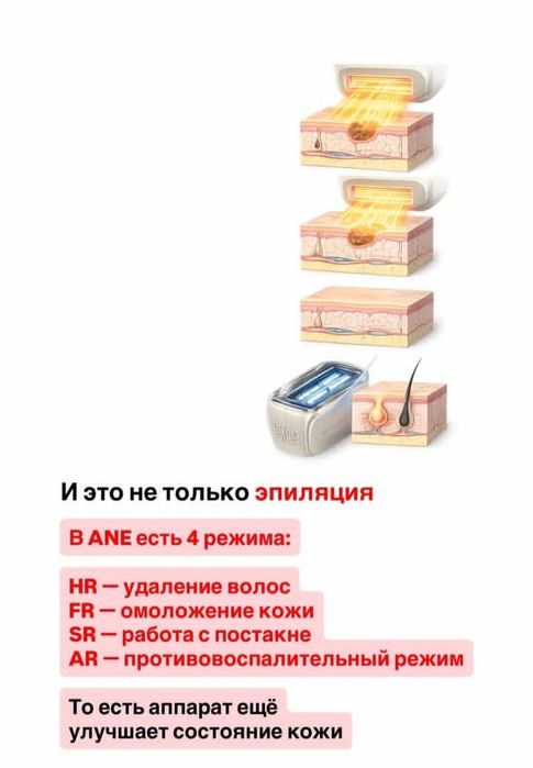 Продам фотоэпилятор