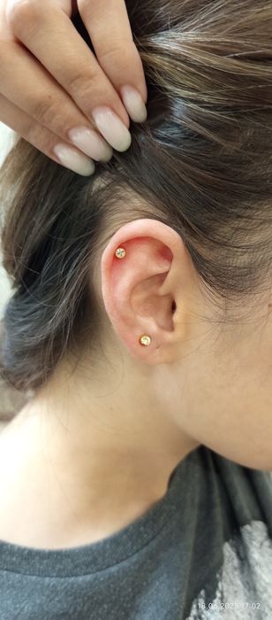 Og'riqsiz Quloq Burun teshamiz