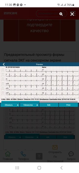 ЭКГ 3 каналный ZONCARE E 10. 
Extreme Simplicity 3-Ch ECG Machine

Нов