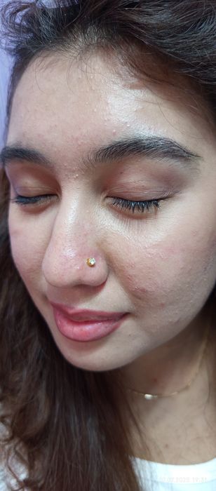 Og'riqsiz Quloq Burun teshamiz