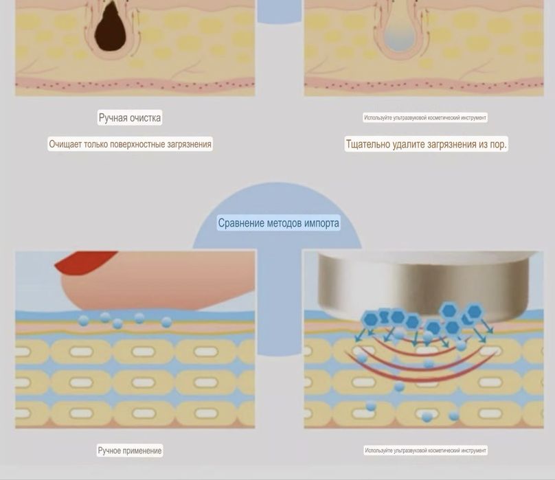 Ультразвуковая терапия