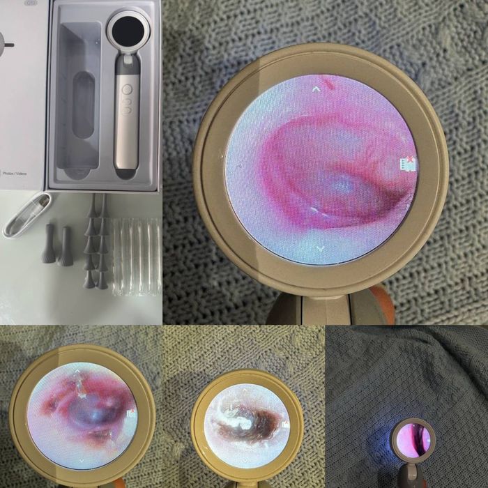 HD формат Отоскоп. ЛОРлар учун.Кулок ва бурунни расмга олади!