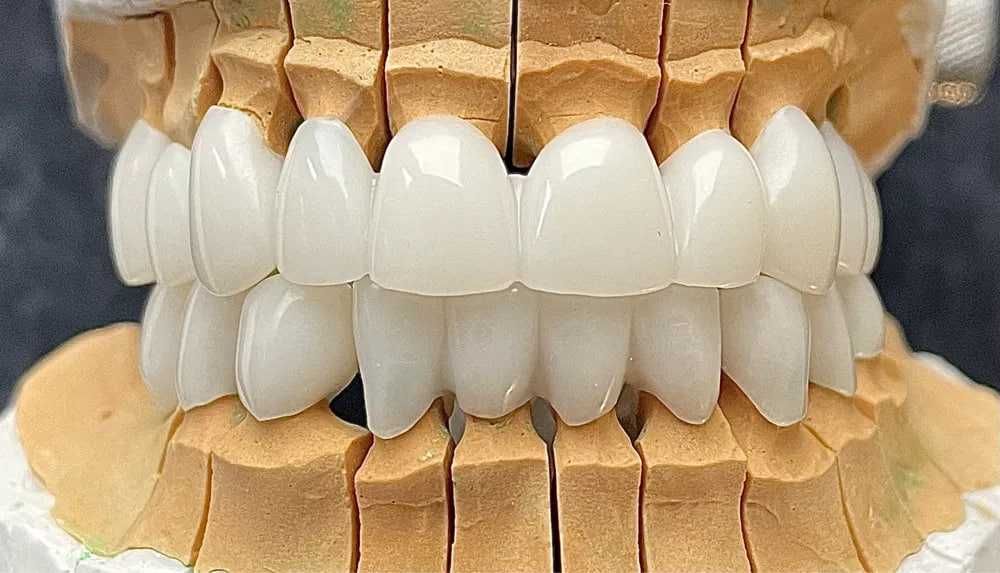 Цифровая стоматология CAD/CAM Зуботехнические услуги