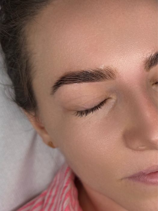 Servicii extensii gene - laminare