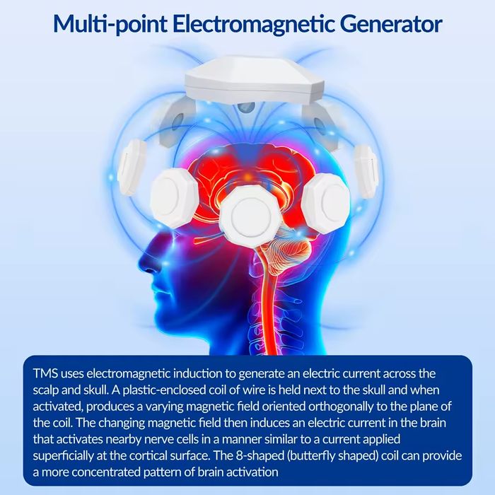 Професионална RTMS транскраниална магнитна стимулационна машина