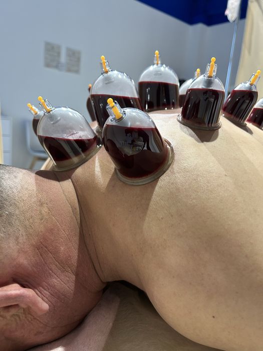 Хиджама в Караганде ! В центре !