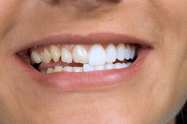 Услуги протезирования и хирургии! Стоматолог 30 л стаж