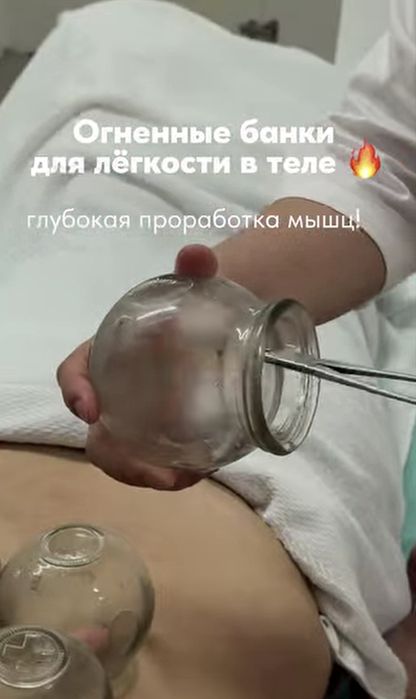 Массаж, банки, иглотерапия, хиджама