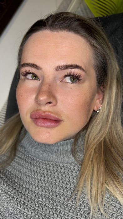 Gene fir cu fir 1D-3D grasit zona colentina - voluntari