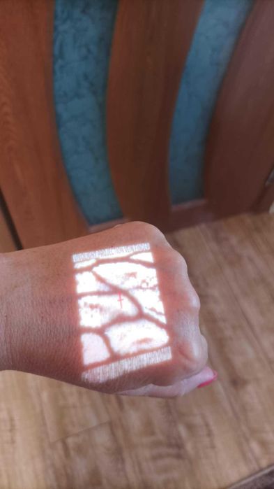 Търсач на вени VIVO 500S