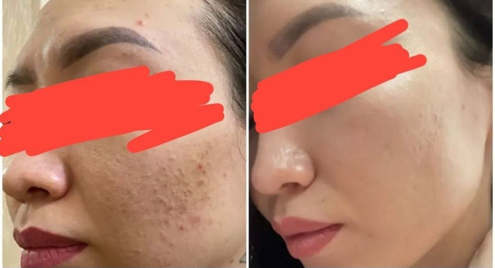 Yuz parvarishi va kosmetolog xizmatlari (uy sharoitida)