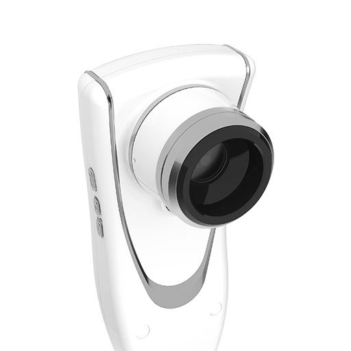 Дерматоскоп Aramo Smart Wizard (ASW-300)