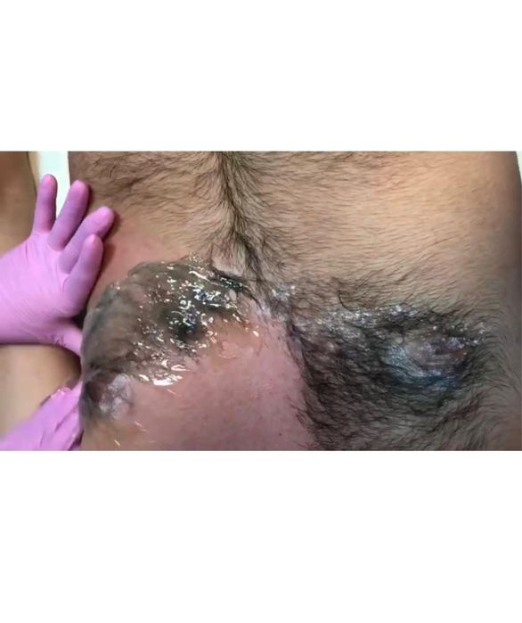 Шугаринг для мужчин БЕСПЛАТНО