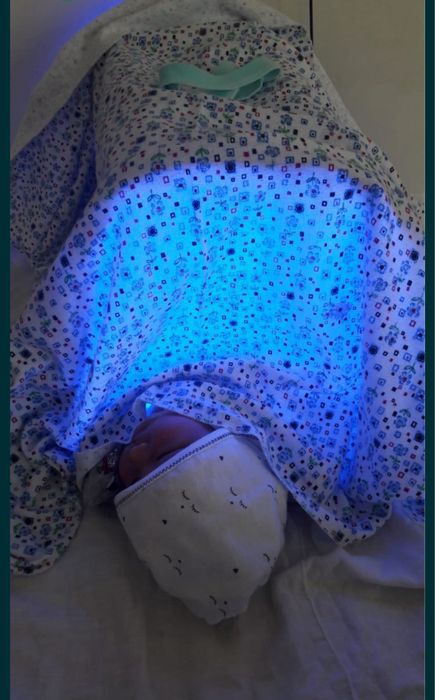 эффективная 100%/фотолампа от желтухи/желтушки/кювез/аренда