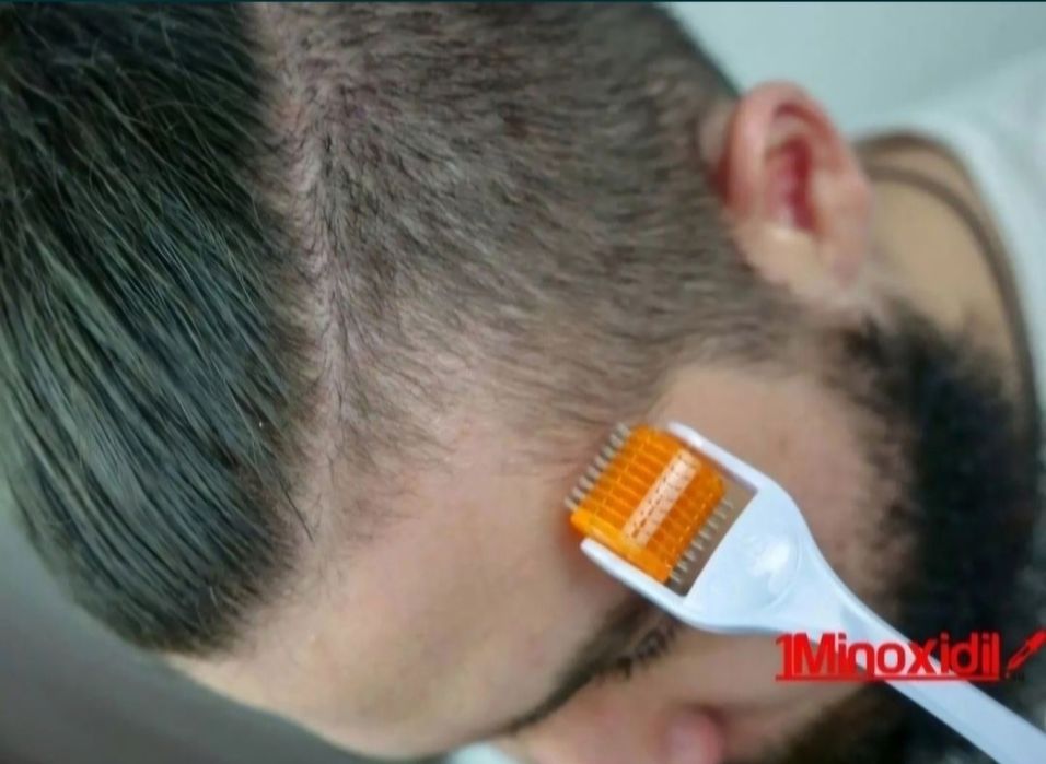 Лосьон для волос