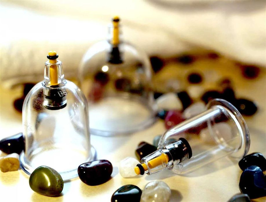 Хиджама выездом на дом гирудотерапия