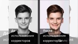 корректоры для ушей у новорожденных и у взрослых исправление форм