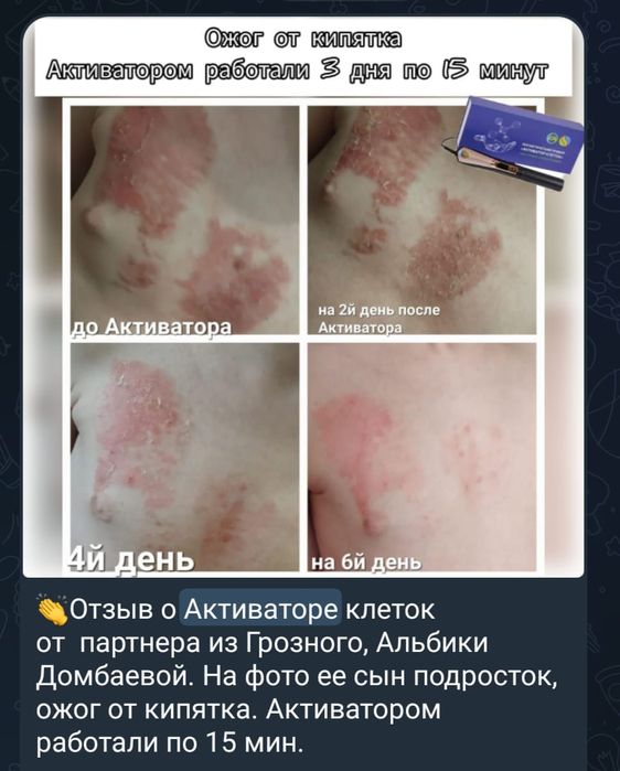 Продаётся Активатор Клеток