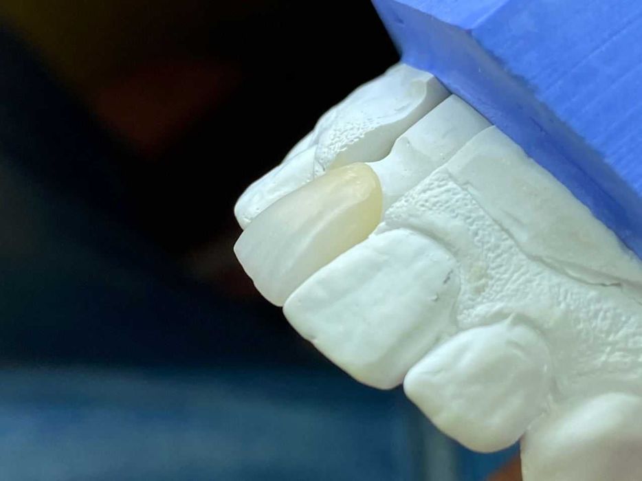 CAD/CAM Услуг Зуботехник Высококачественные Циркониевые Зуб Стоматолог