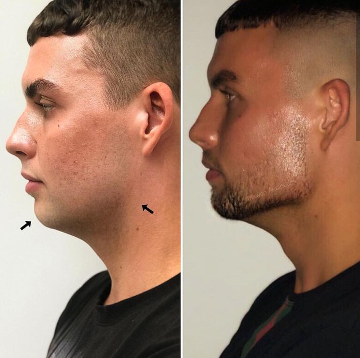 Оформи страхотна челюст и лице