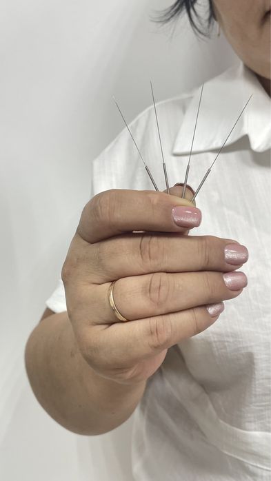 Хиджама, Иглотерапия, Пиявки, Массаж, Плазмолифтинг